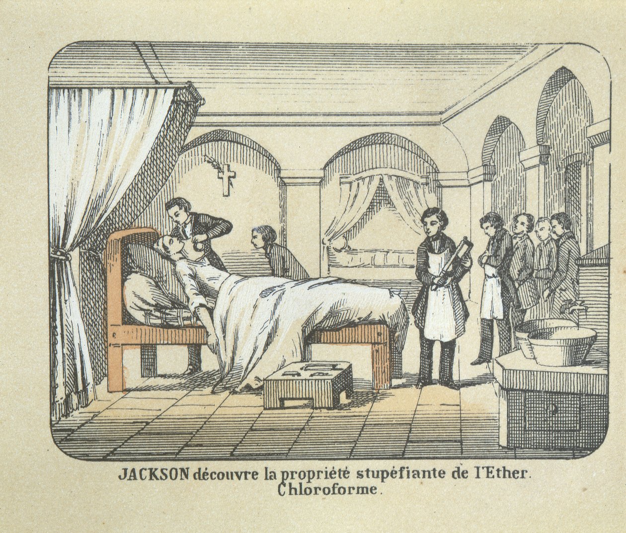 Dr. Charles Jackson (1805-80) oppdager eterens bedøvende egenskaper av French School