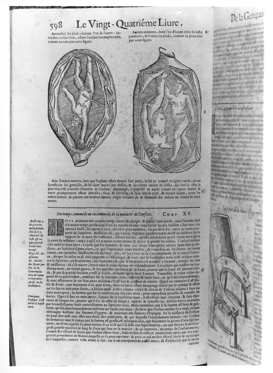 Foetus, illustrasjon fra Oeuvres av Ambroise Pare (1509-90) utgitt i Lyon, 1641 av French School