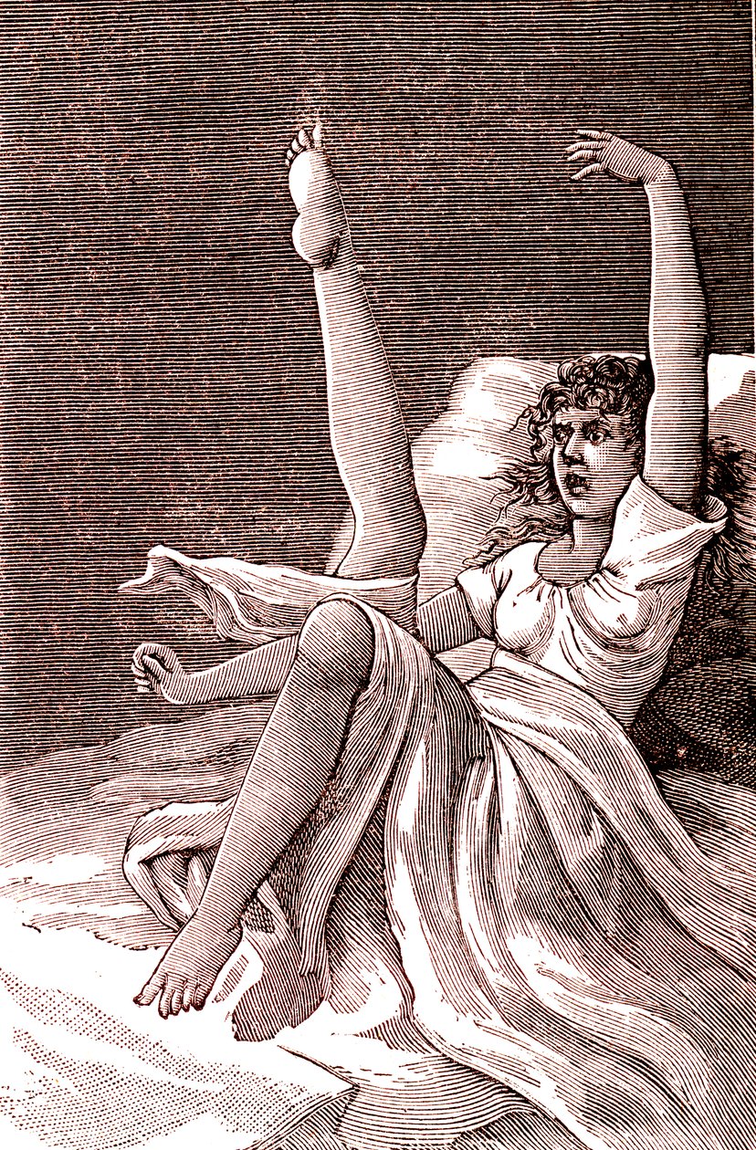 Hysteri, et ekstremt mentalt fenomen, psykoser og psykoneurose.1887 (gravering) av French School