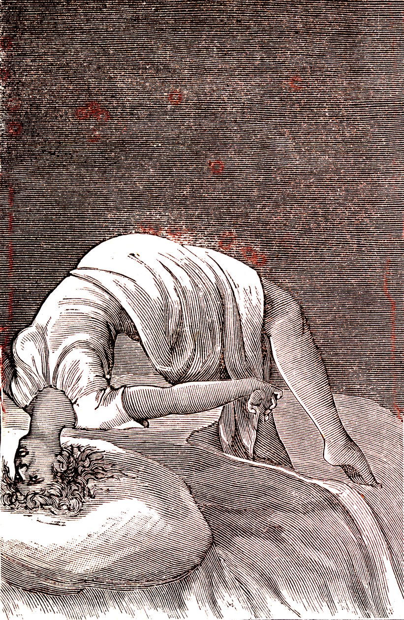 Hysteri, mental og nervøs lidelse, som oppstår fra intens angst. 1887 (gravering) av French School