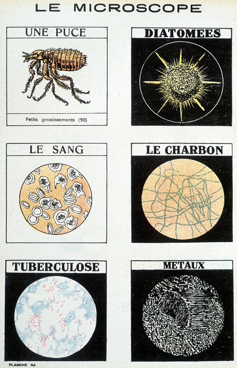 Mikroskoper: en brikke, kiselalger, blod, kull, tuberkulose, metaller. av French School