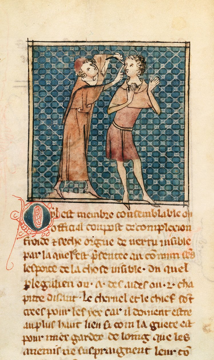 Ms 2030 fol.17 Oftalmology, illustrasjon fra La Chirurgie de Maitre Henri de Mondeville av French School