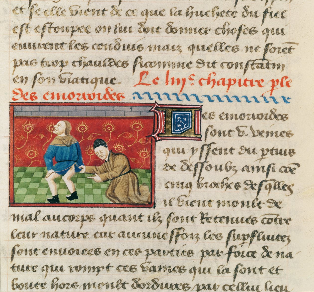 Ms 22532 Undersøkelse av en pasient med hemorroider, fra Le Livre des Proprietes des Choses av Barthelemy lAnglais, ca. 1410-15 av French School