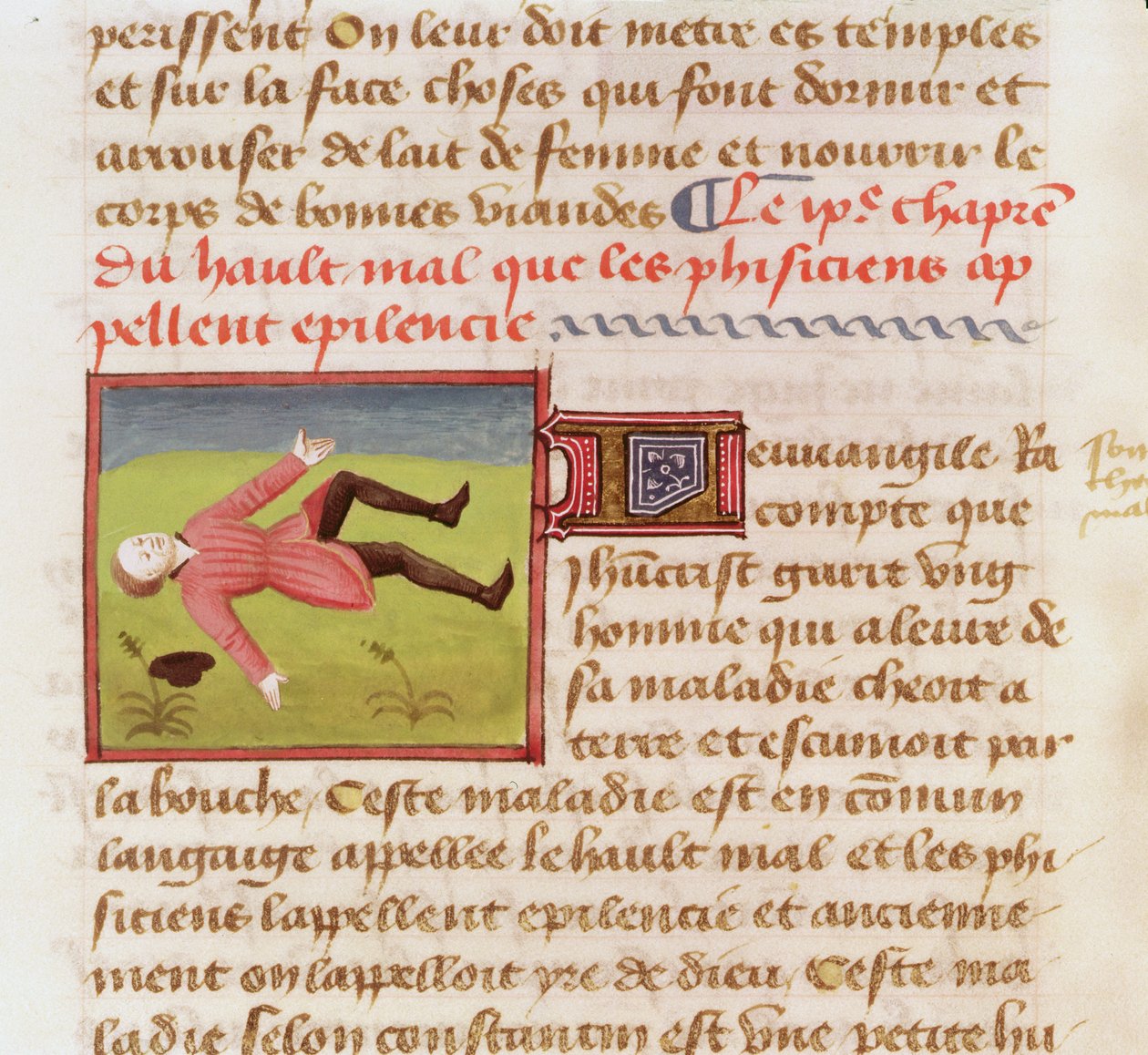 Fru 22532 Pasient som lider av et epileptisk anfall, fra The Book of the Properties of Things av Barthelemy langlais, ca. 1410-15 av French School