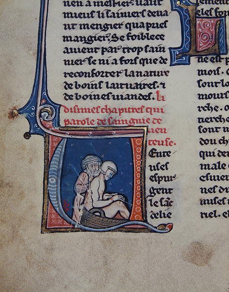Ms 2510 Auskultasjon av en syk mann (vellum) av French School