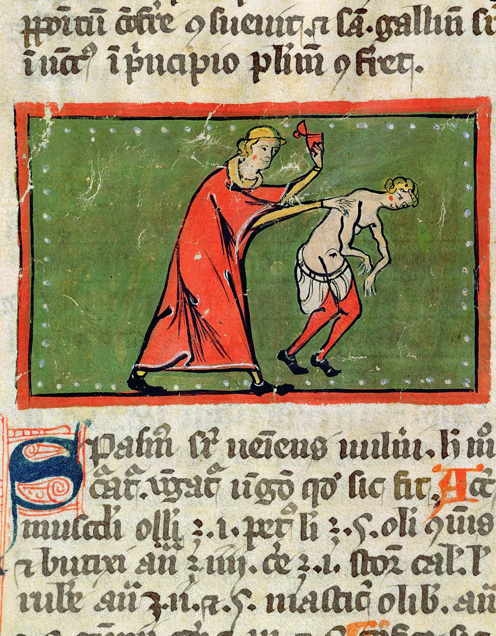Ms H 89 Lege som behandler en pasientrygg, fra en utgave av Book of Surgery av Rogier de Salerne av French School