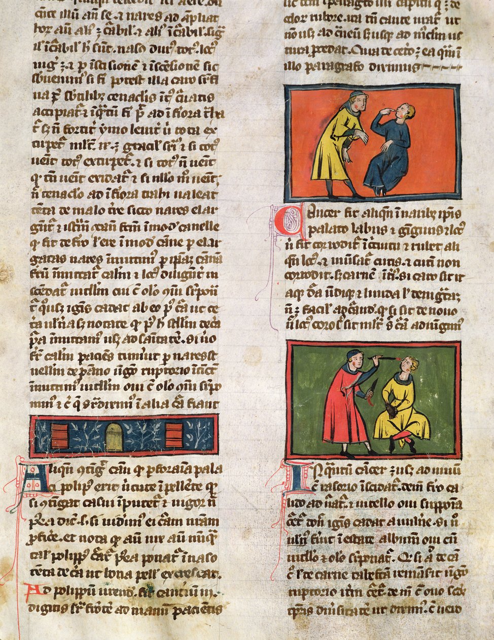Ms H 89 Doctors and Patients, fra en utgave av Book of Surgery av Rogier de Salerne av French School