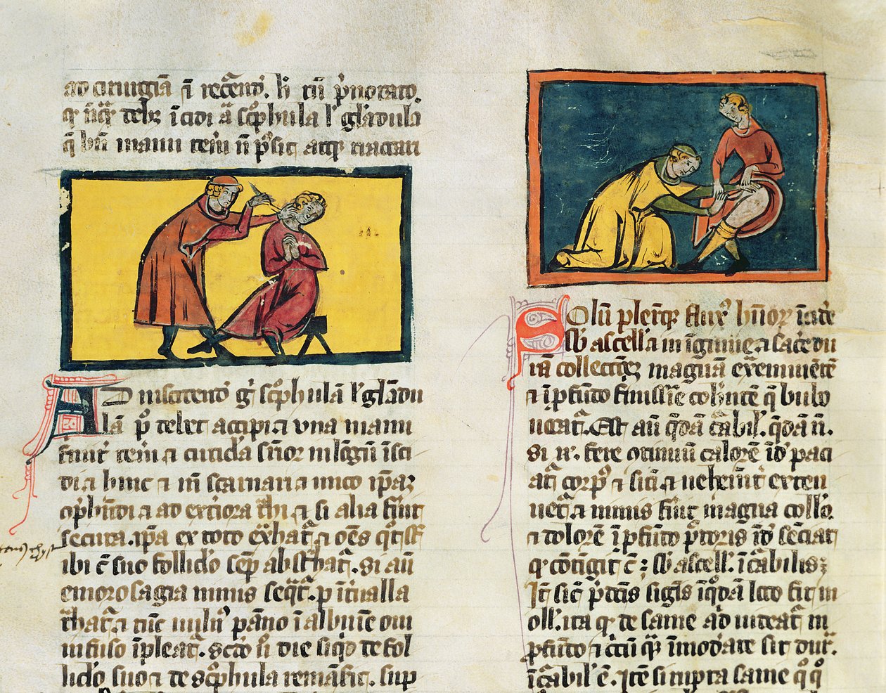 Ms H 89 Doctors curing the sick, fra en utgave av Book of Surgery av Rogier de Salerne av French School