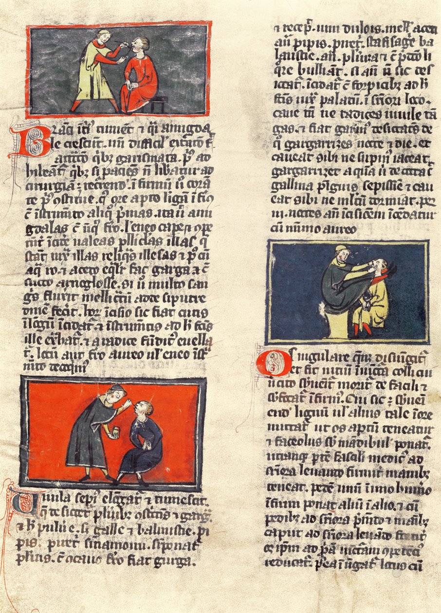 Ms H 89 fol.16v Dental Surgery, fra en utgave av 