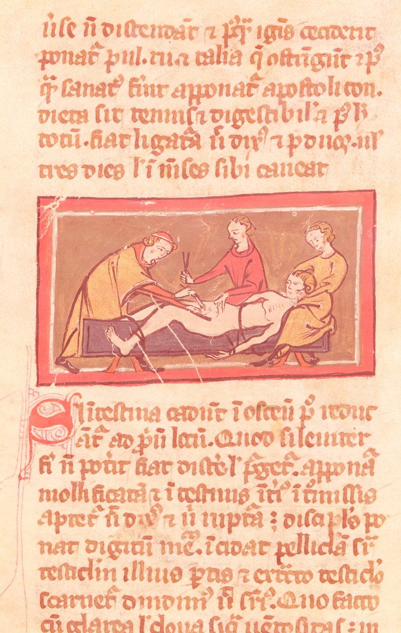 Ms H 89 fol.23 Surgery, fra en utgave av Book of Surgery av Rogier de Salerne av French School