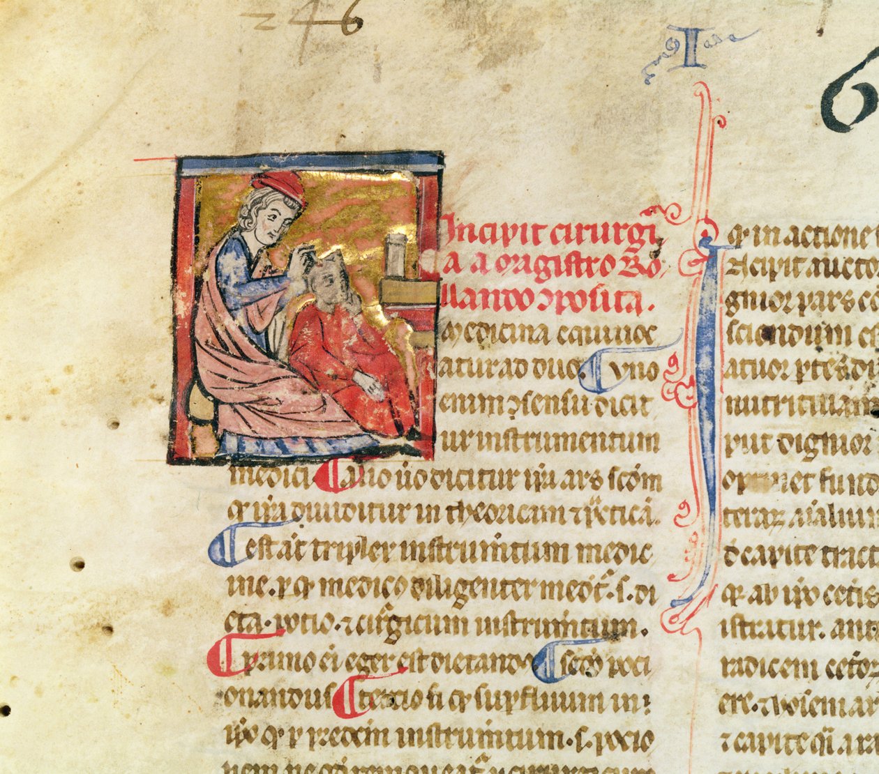 Ms Lat. 7134 fol.1 Trepanation, fra Kirurgi av Maitre Rolandi av French School