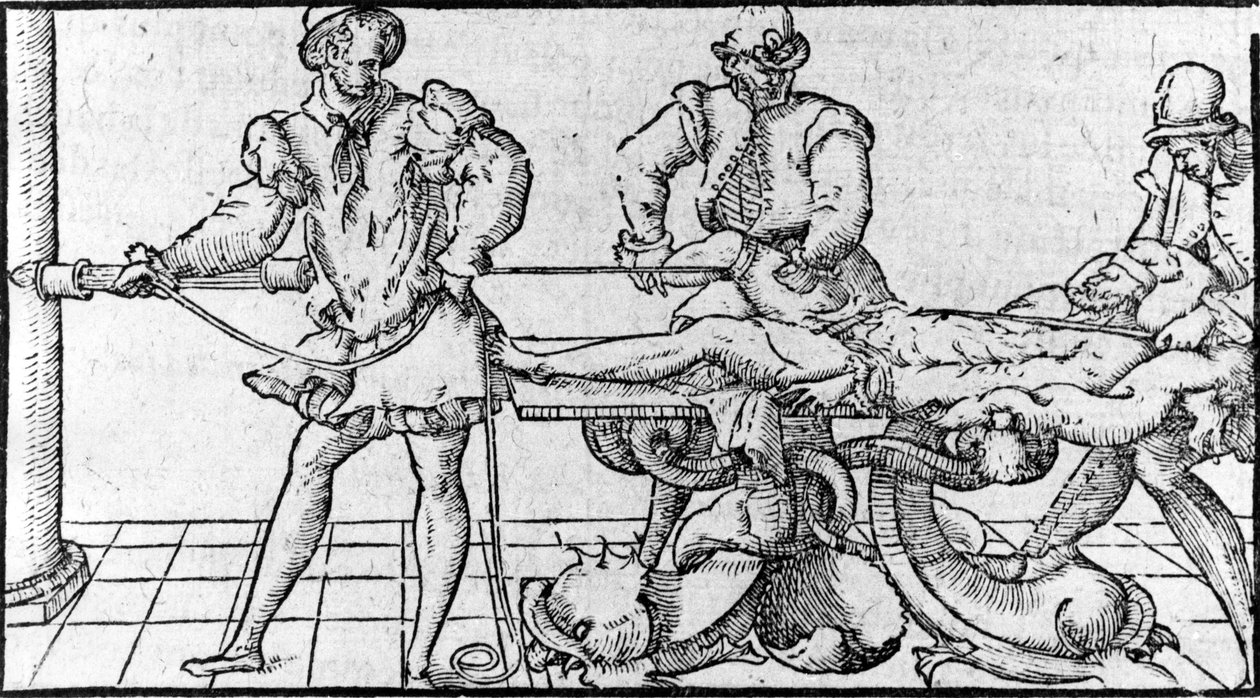 Reduksjon av dislokasjon, -i "Medical Treaty of Ambroise Paré"", ca 1560. av French School