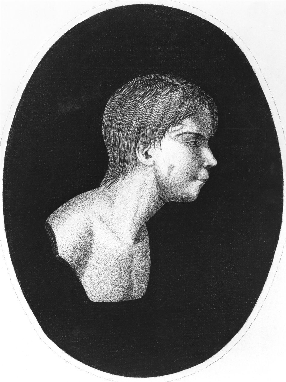 Victor of Aveyron, frontispice av De lEducation dun homme sauvage av J.E.Itard av French School