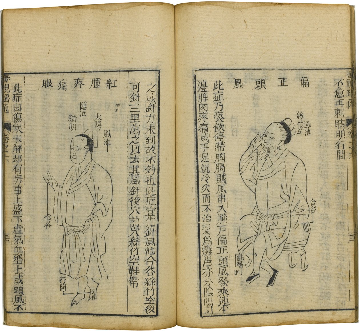 Shen Shi Yao Han A Precious Book of Ophthalmology, 1644 av Fu Renyu