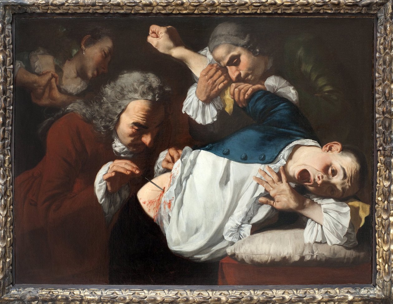 Operasjon. Maleri av Gaspare Traversi (ca. 1722-1770), olje på lerret, ca. 1753-1754. Italiensk kunst fra 1700-tallet. Staatsgalerie Stuttgart (Tyskland). av Gaspare Traversi