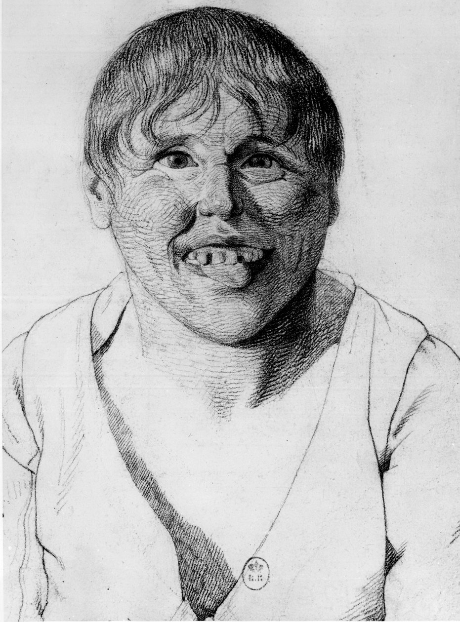 Cretine, -i ""Study of the physiognomy of aliens"", tegning av Gabriel av Georges Francois Gabriel