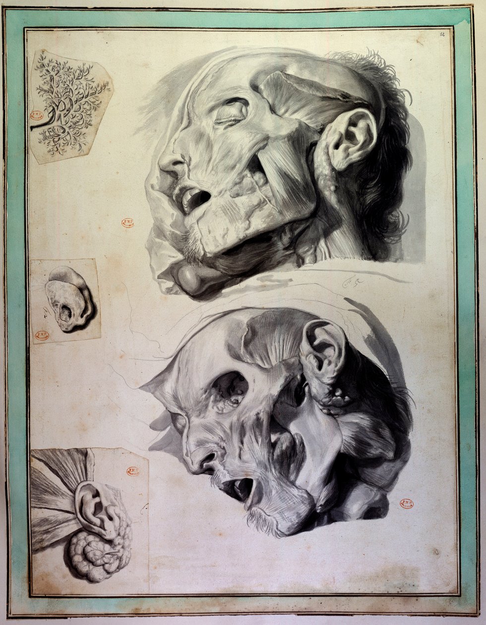 Avbarkede menneskehoder: muskler og skjeletter er synlige. Gravering av Gerard de Lairesse (1640-1711) som illustrerer "Anatomia Humani Corporis" av Govert Bidloo (eller Govard) (1649-1713) 1700-tallets bibliotek ved Det medisinske fakultet, Paris av Gerard de Lairesse