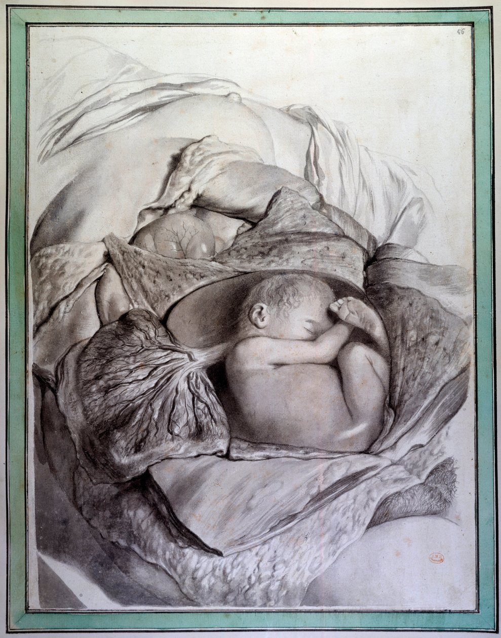 Representasjon av et foster av et menneske i en livmor Gravering av Gerard de Lairesse (1640-1711) som illustrerer "Anatomia Humani Corporis" av Govert Bidloo (eller Govard) (1649-1713) 1700-tallets bibliotek ved Det medisinske fakultet, Paris av Gerard de Lairesse
