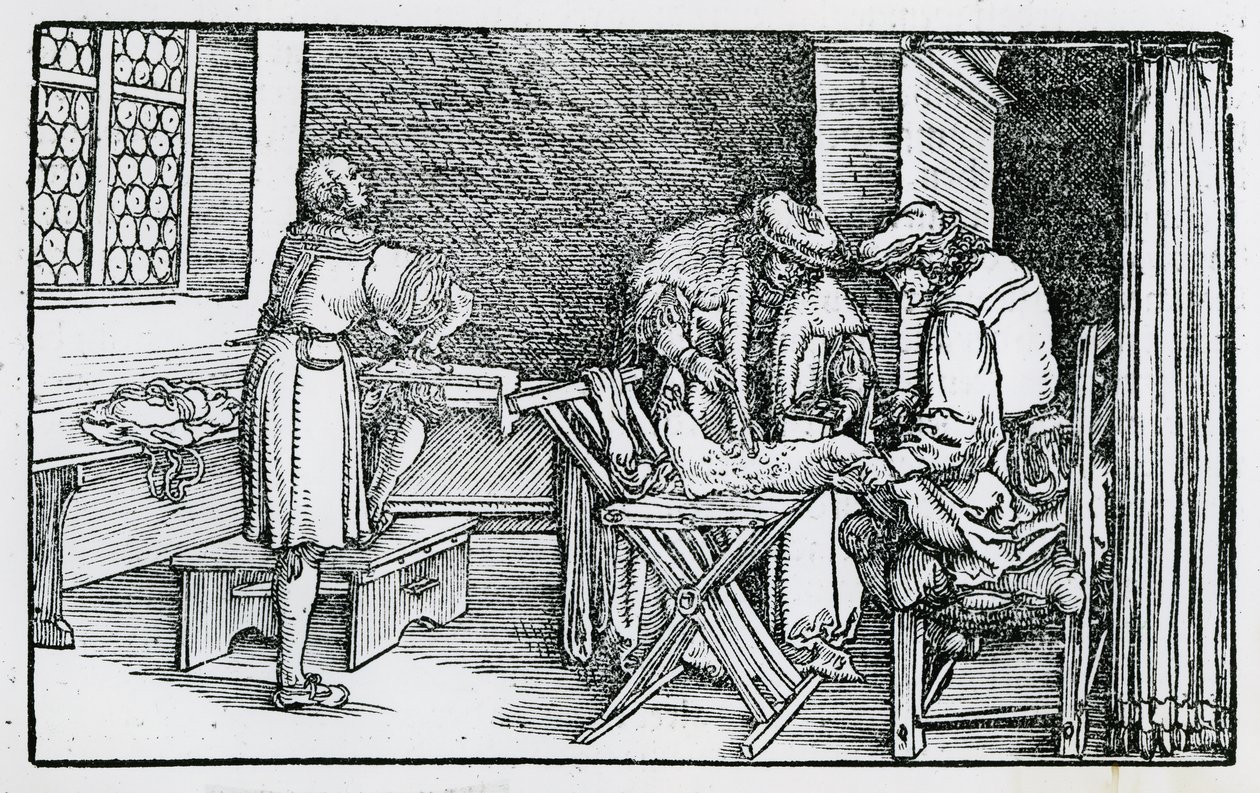 Behandlingen av et gangrenøst ben av German School