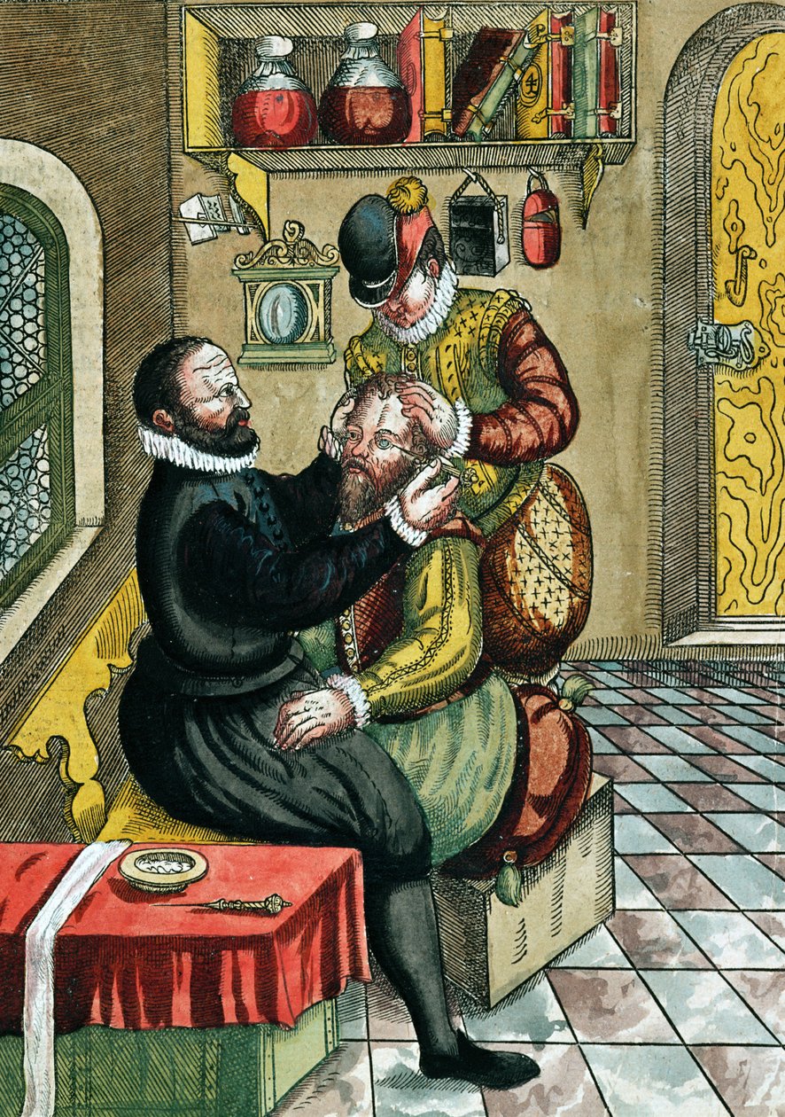 Cataract Operation, fra Ophthalmodouleia av Georg Bartisch (1535-1636) utgitt i Dresden i 1583 (farget treblokktrykk) av German School