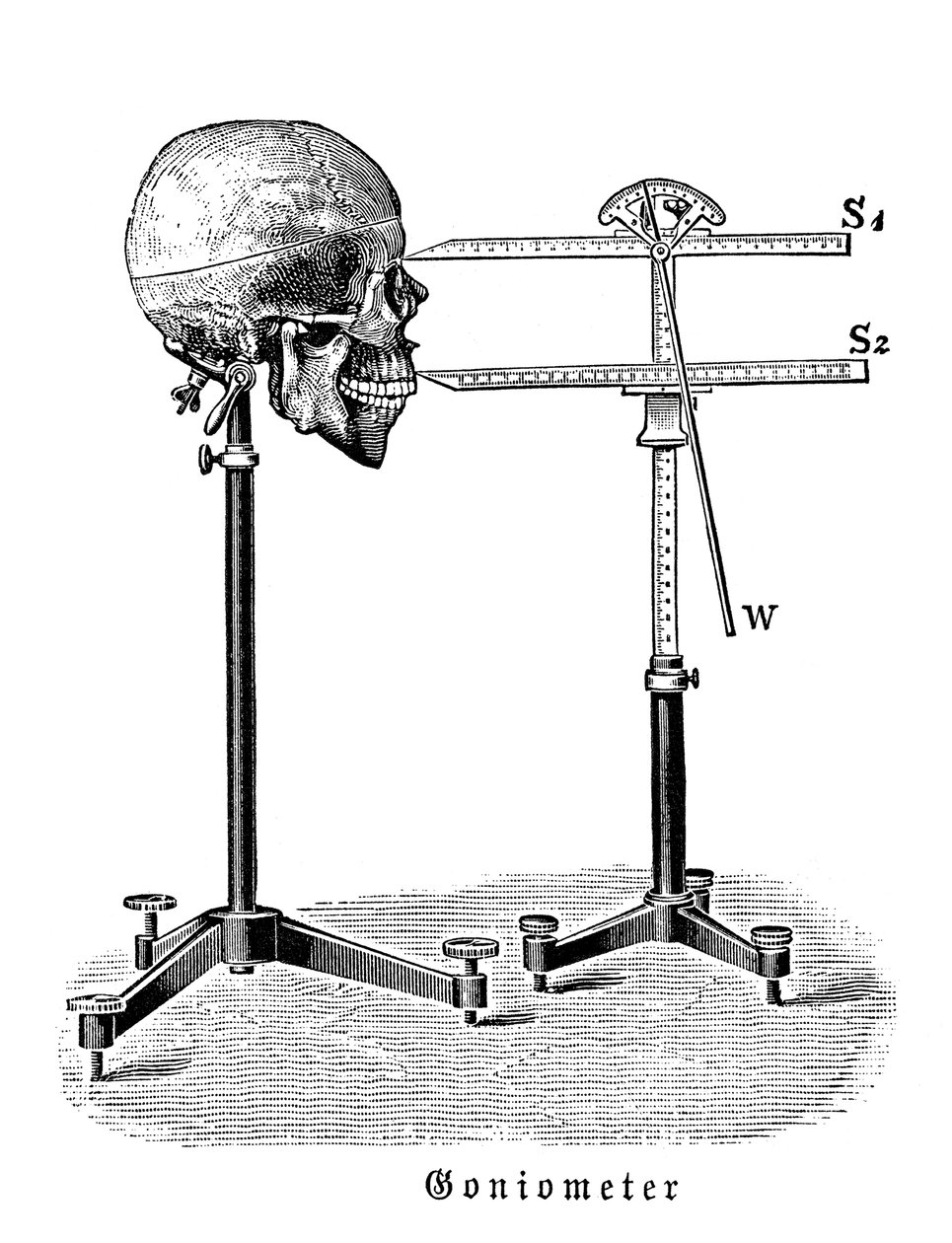 Goniometer som måler menneskeskalle av German School
