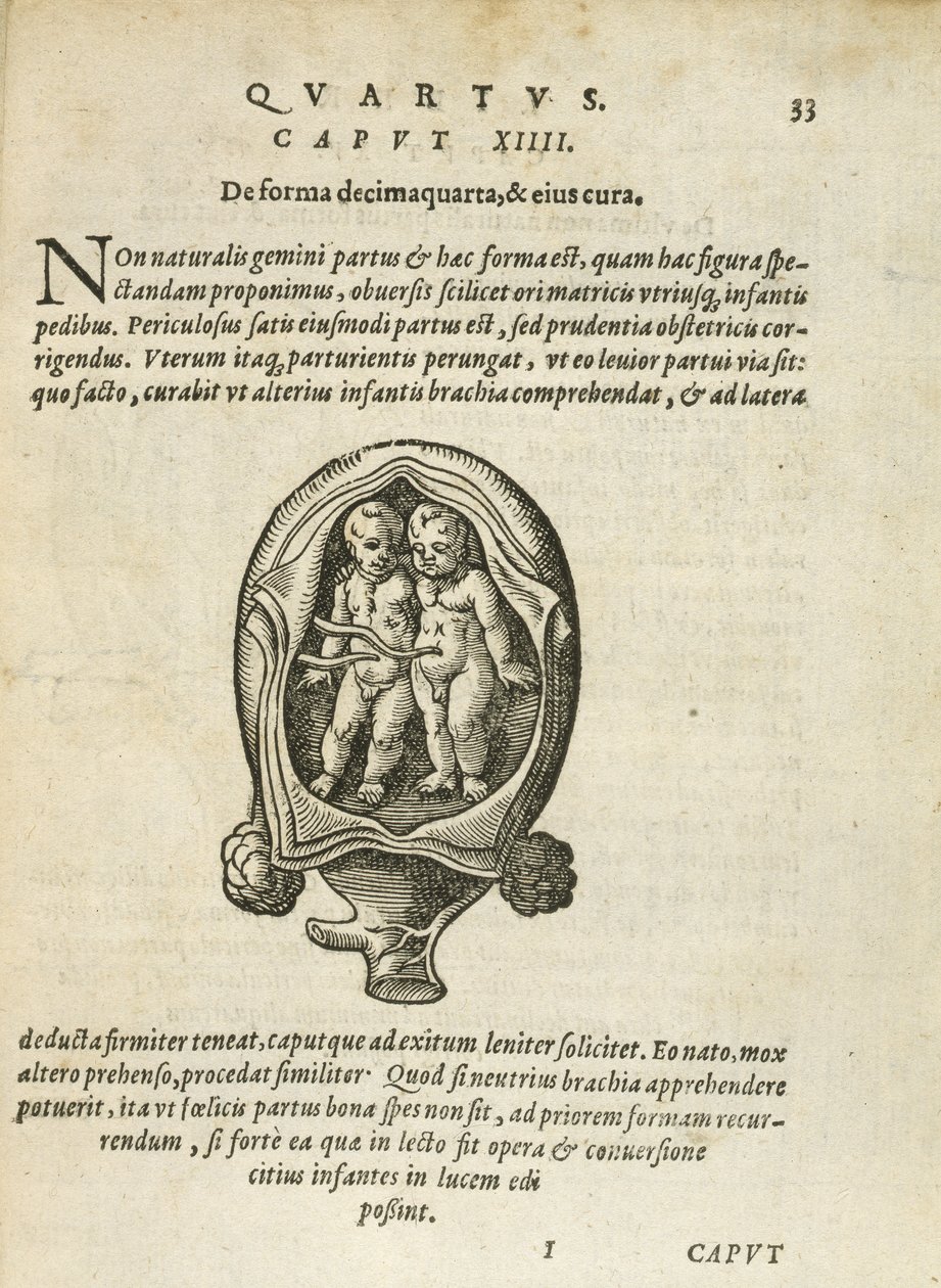 Ikke-identiske tvillinger i livmoren, illustrasjon fra kapittel 14, bok 4 av On the Conception and Growth of Man av Rueff, 1587 av German School