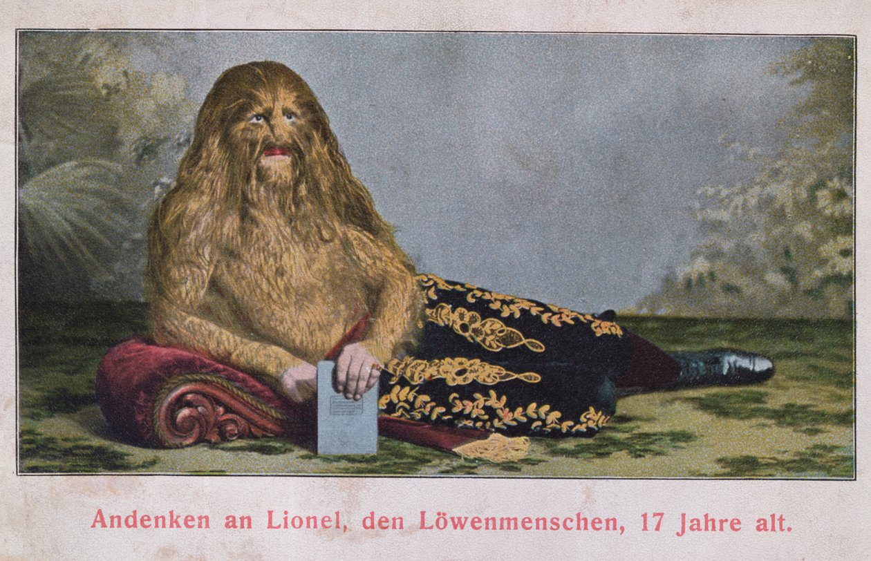 Postkort som viser Lionel the Lion Boy på 17 år, 1909 av German School