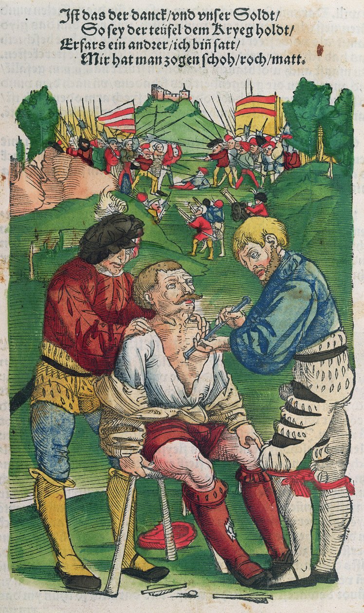 Fjerning av en pil, illustrasjon fra Feldtbuch der Wundartzney av Hans von Gersdorff, 1540 av German School