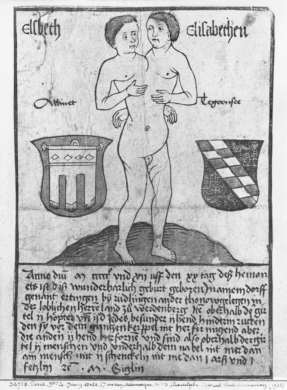 Siamesiske jenter, Elsbeth og Elisabethen (tresnitt & wc) av German School