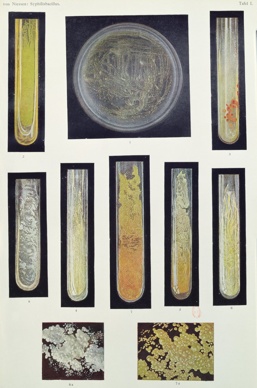 Syphilus Bacillus, fra en bok av Max von Niessen, Leipzig, 1908 av German School