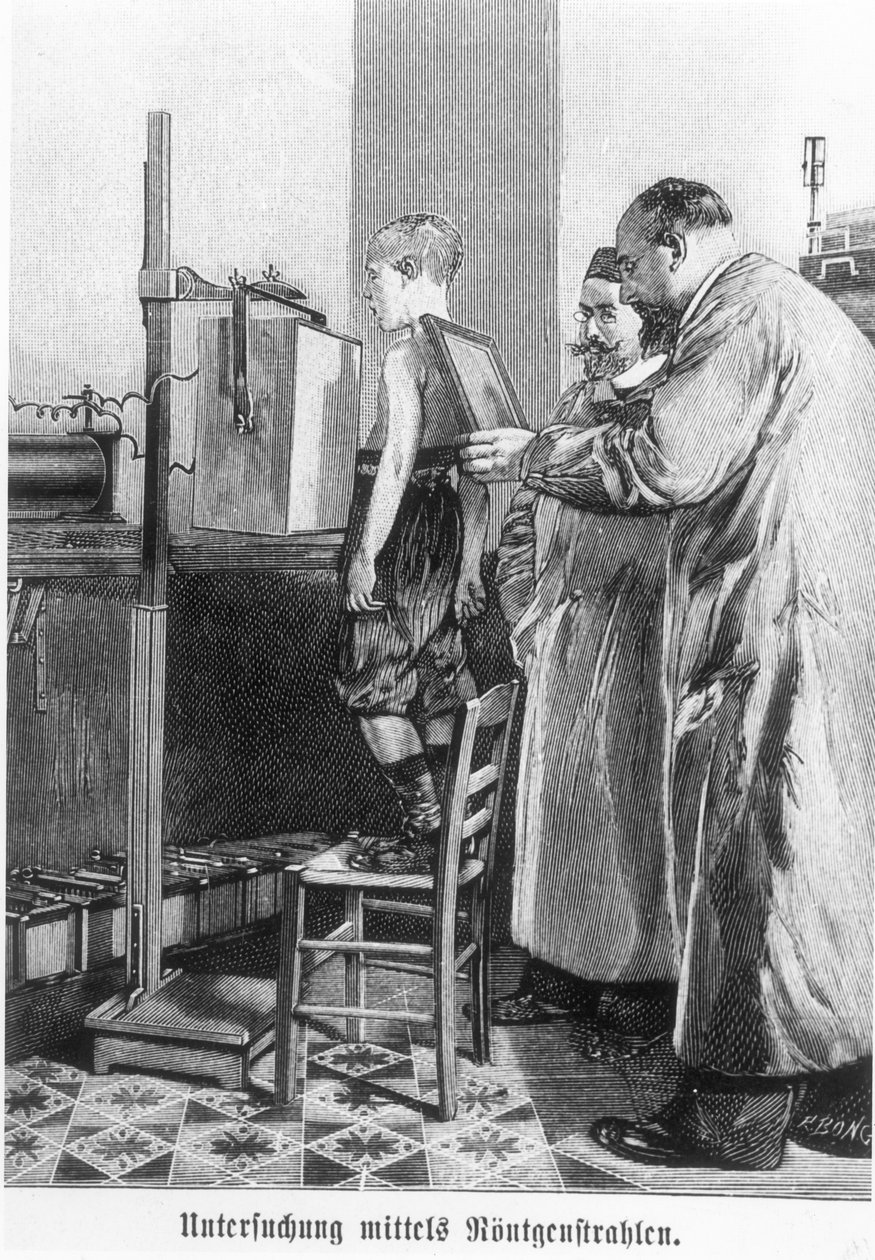 Wilhelm Konrad Roentgen (1845-1923) røntgenbilder av en ung gutt, fra en bok av Hans Kraemer, ca. 1898-99 av German School