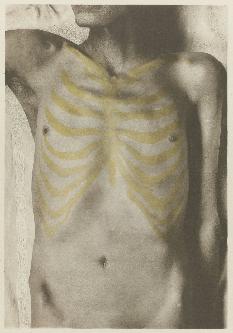 Anatomisk foto av en mannelijk lijk: 'de vorm van de borstpartij in relatie tot het skjelett' (Brystets form i forhold til skjelettet) Atlas over menneskelig anatomi til bruk for kunstnere: reproduksjon og illustrasjon, anatomisk av Giulio Chiarugi (attributed to)