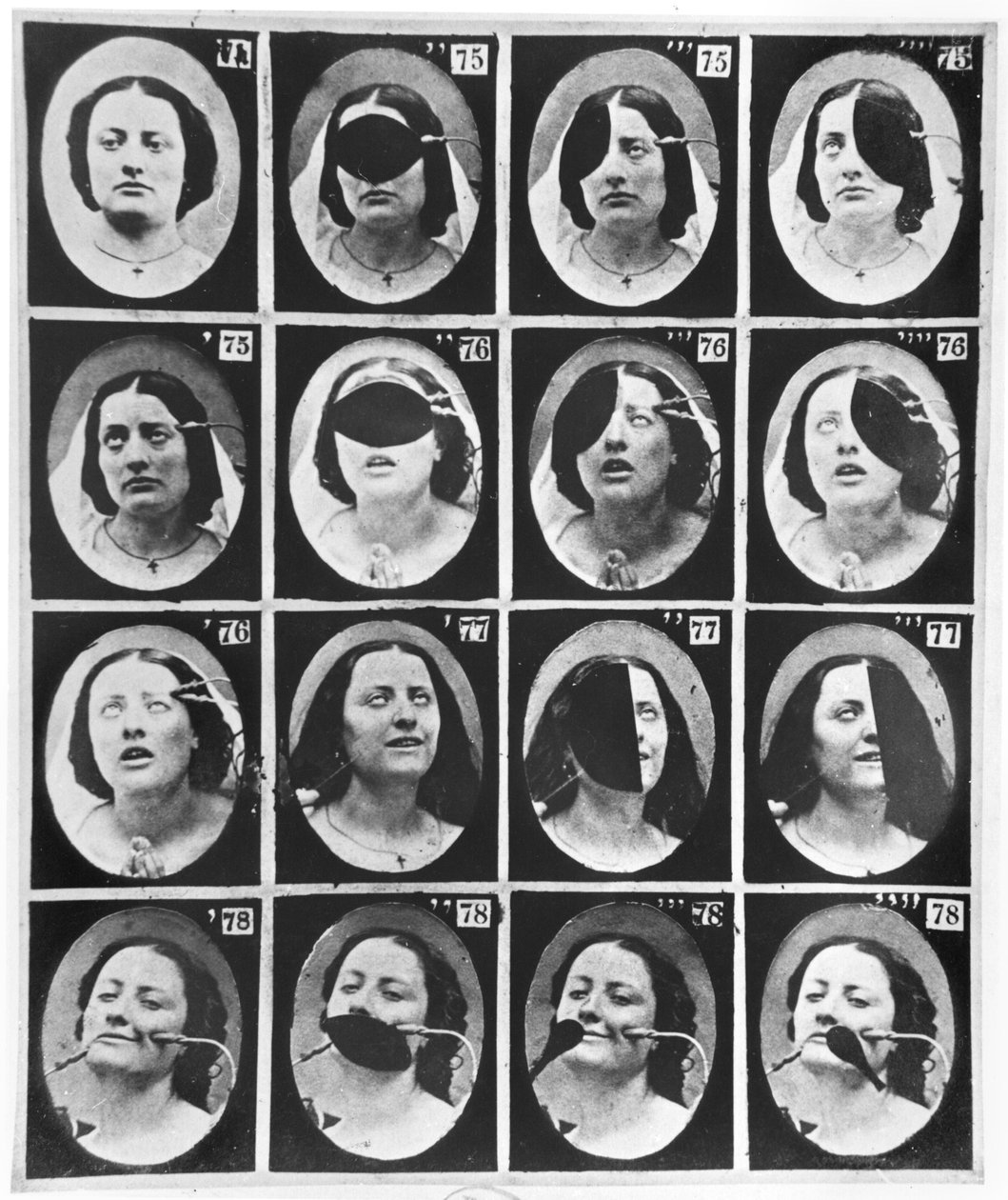 Fysiognomiske studier, fra 'Mechanism of human physiognomy or electrophysiological analysis of passions' av Duchenne de Boulogne, publisert 1876, Paris av Guillaume Benjamin Armand Duchenne de Boulogne