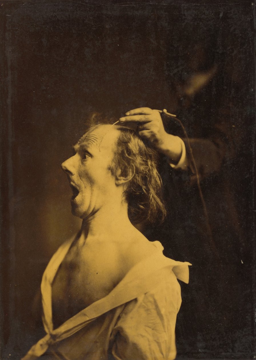  av Guillaume Benjamin Armand Duchenne de Boulogne