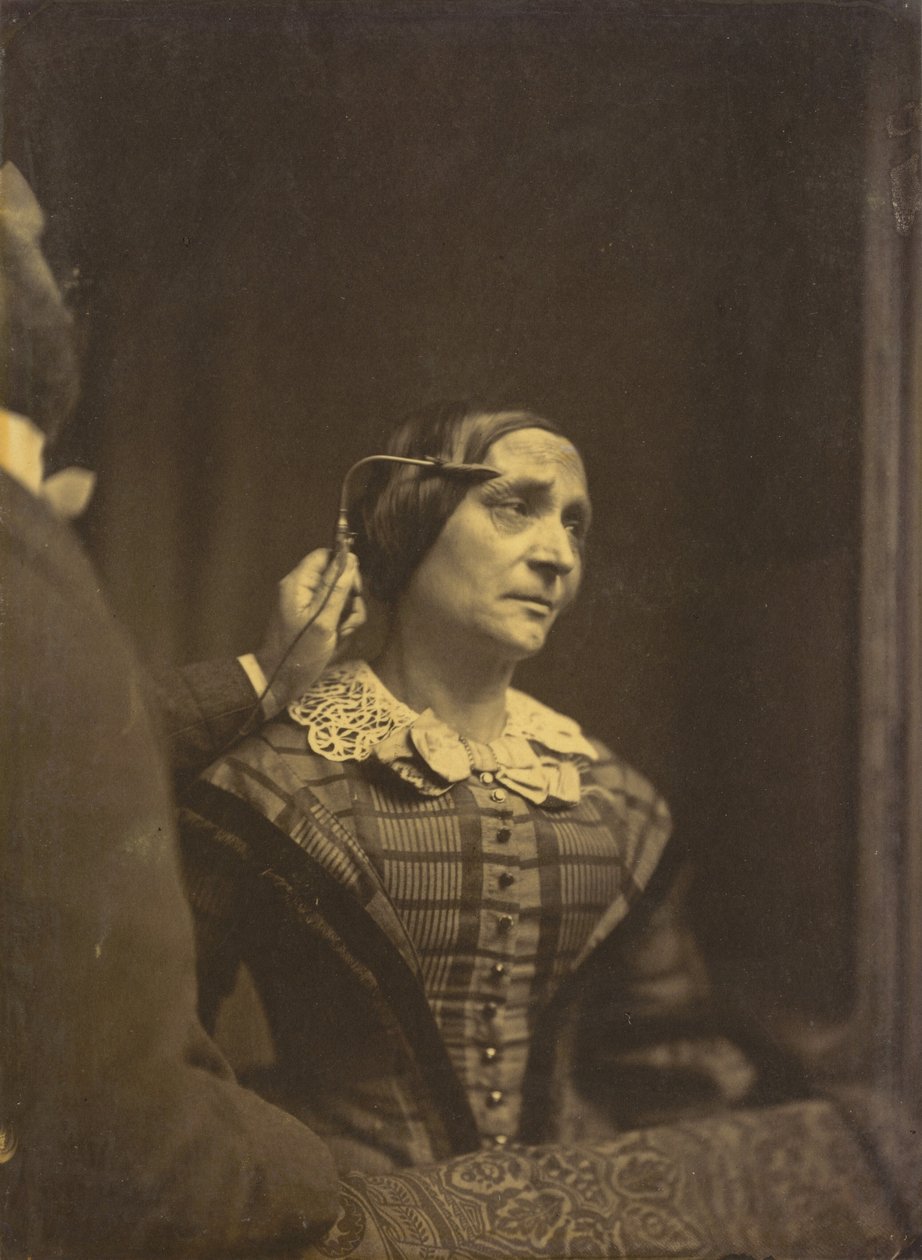  av Guillaume Benjamin Armand Duchenne de Boulogne