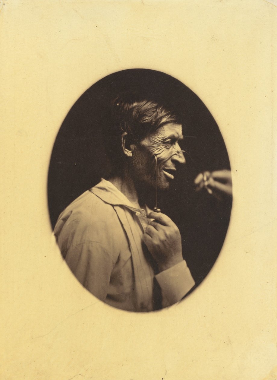  av Guillaume Benjamin Armand Duchenne de Boulogne