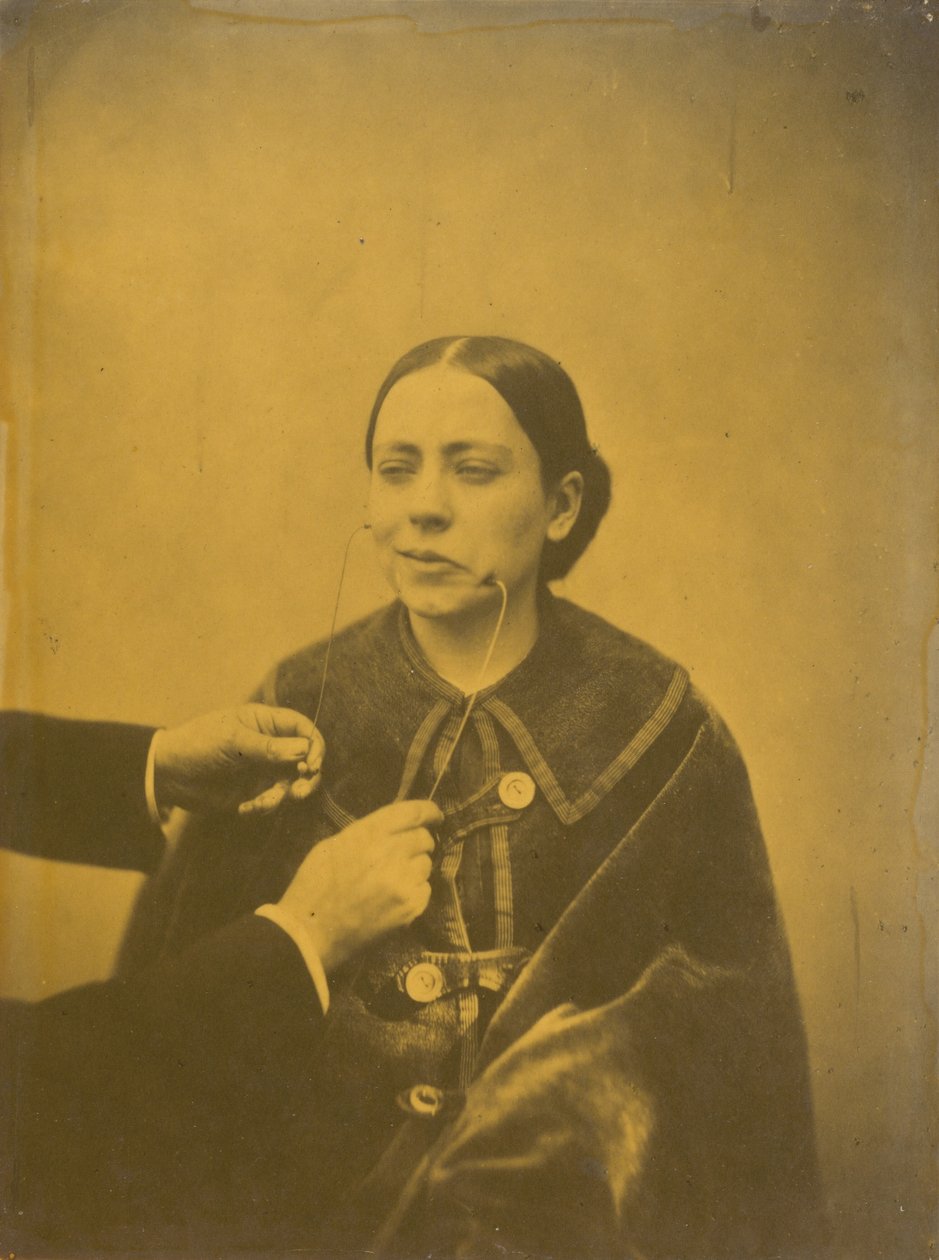  av Guillaume Benjamin Armand Duchenne de Boulogne