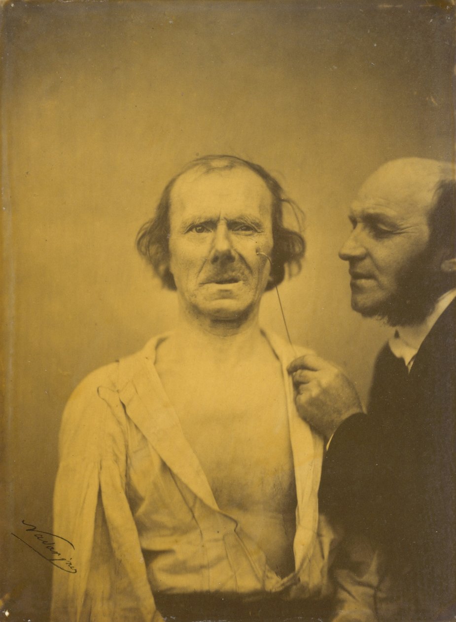  av Guillaume Benjamin Armand Duchenne de Boulogne
