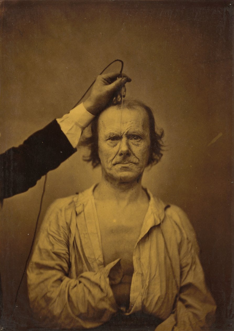 Oppmerksomhet (til venstre); Alvorlighet, aggresjon (høyre) av Guillaume Benjamin Amant Duchenne