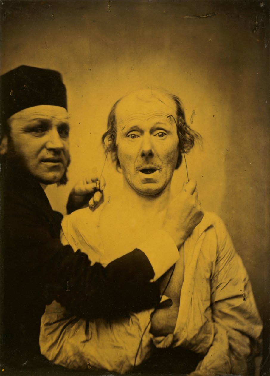 Overraskelse av Guillaume Benjamin Amant Duchenne