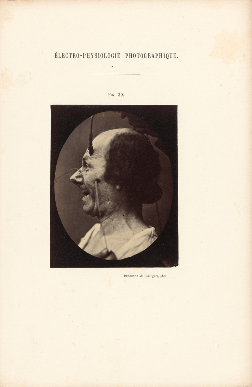  av Guillaume Benjamin Duchenne