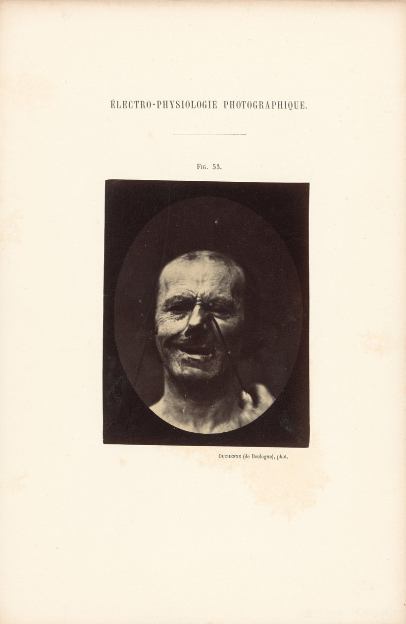  av Guillaume Benjamin Duchenne