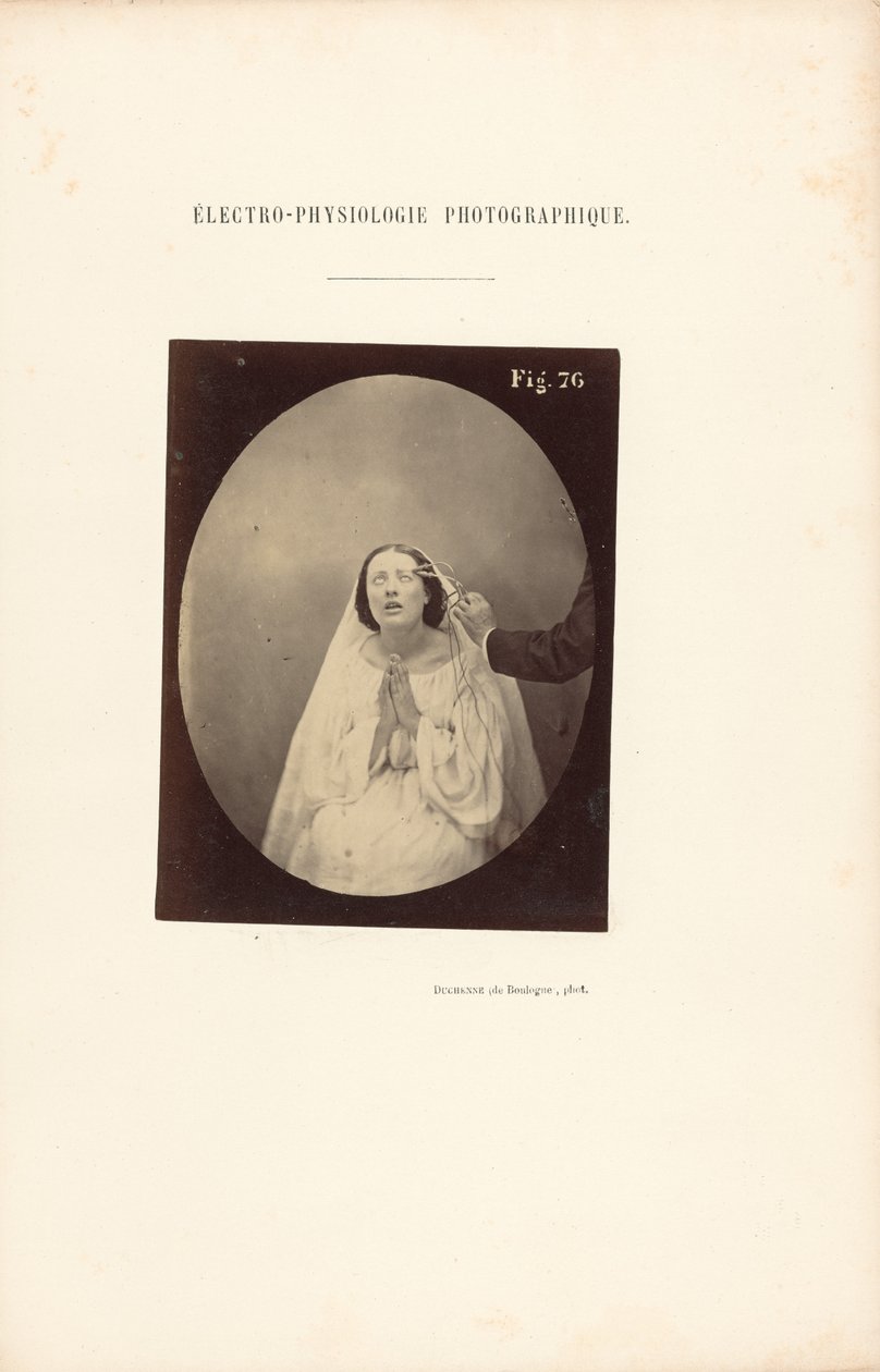  av Guillaume Benjamin Duchenne
