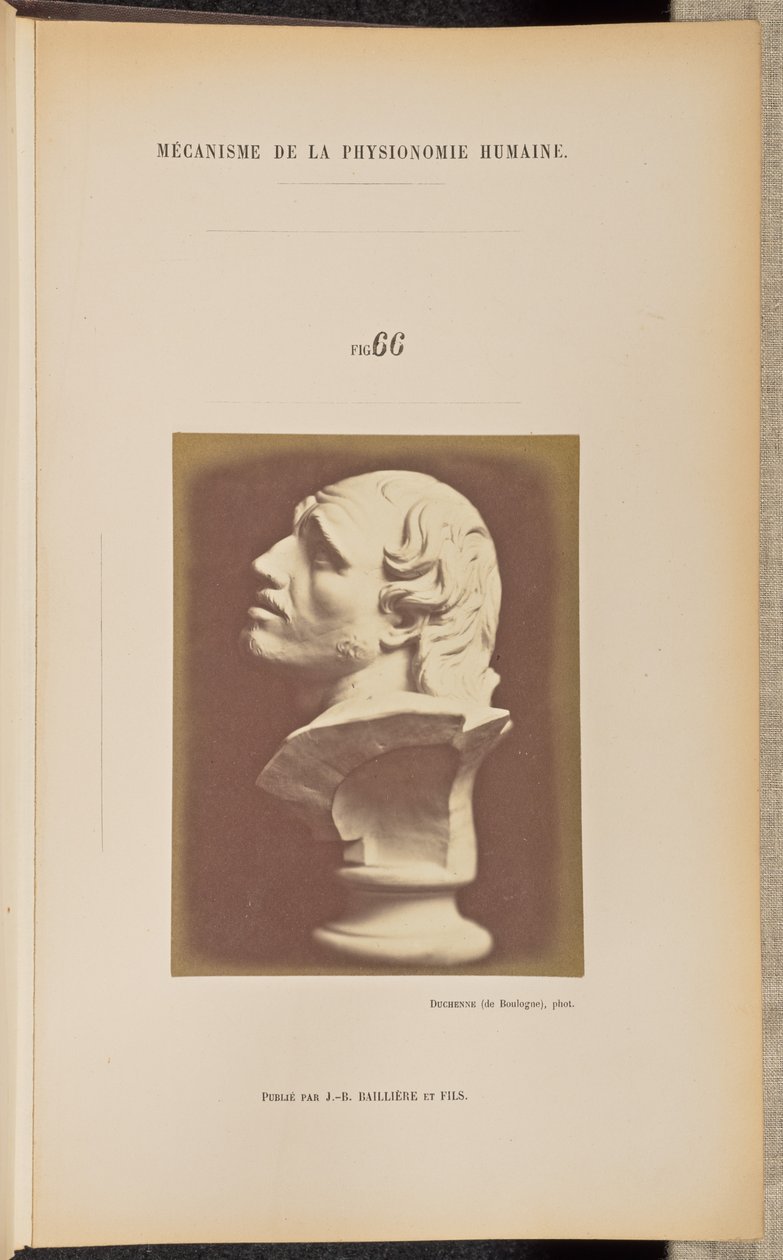  av Guillaume Benjamin Duchenne