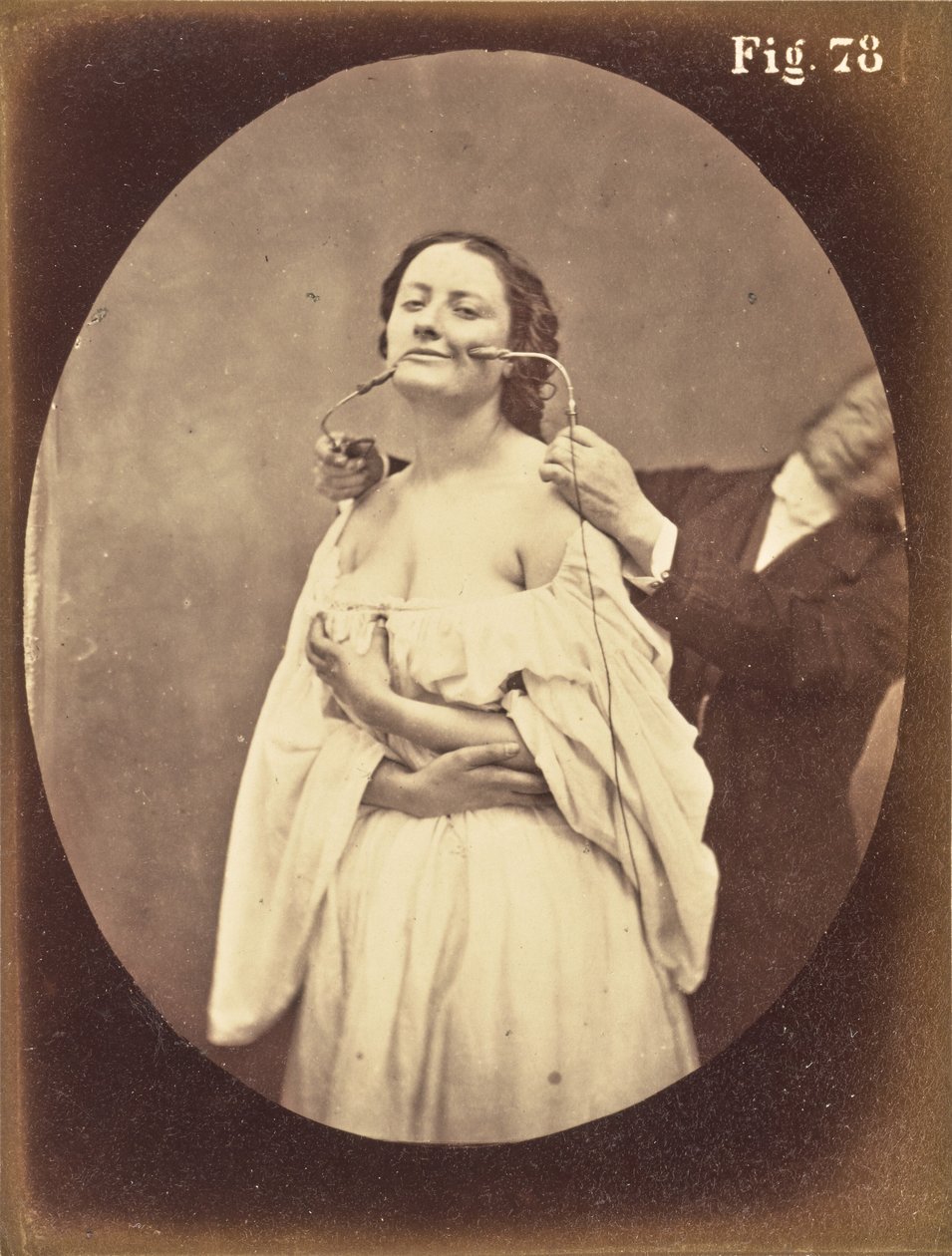  av Guillaume Benjamin Duchenne