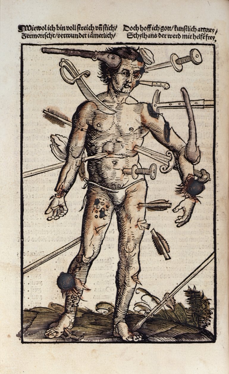 XVIIIv The Wound Man, fra 