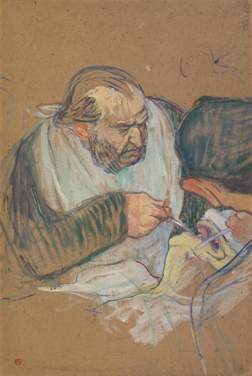 Dr. Péan opererer av Henri de Toulouse-Lautrec