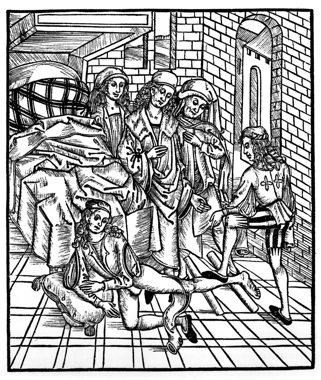 Kirurg regisserer som assistent bryter og tilbakestiller et ben, fra 'Das Buch der Cirugia', utgitt Strasbourg, 1497 av Hieronymus Brunschwig