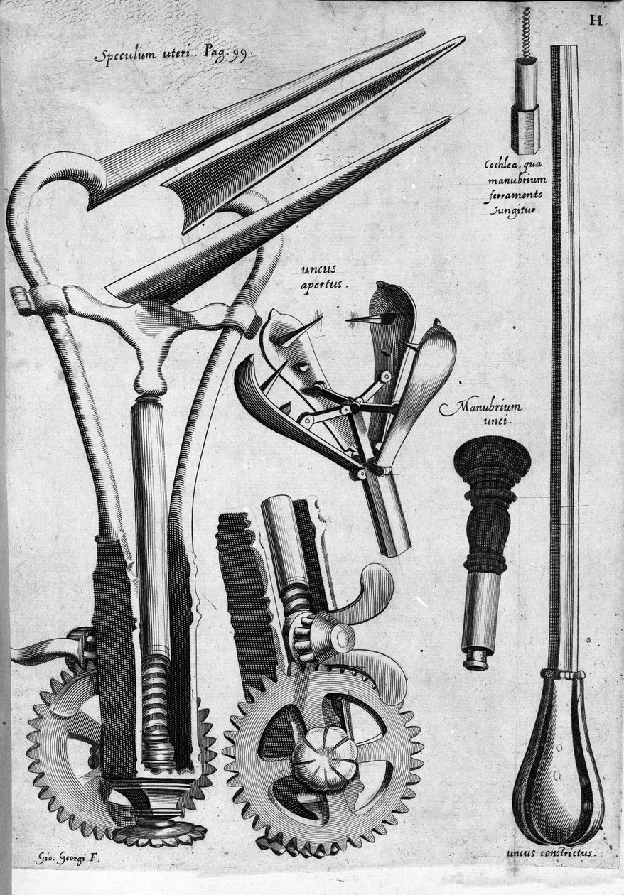 Gynekologi: Plate som representerer et spekulum. Gravering av Girolamo Fabrici i "" Opera Surgical"", Padua av Hieronymus Fabricius ab Aquapendente