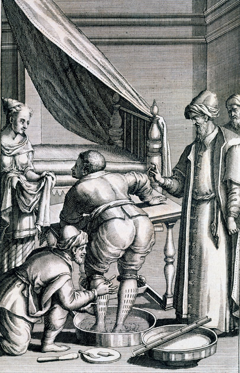 Blodsletting i bena, fra Medicina Aegyptiorum av Prospero Alpini, utgitt 1745 av Italian School